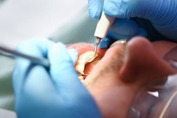 Best Urgent Dental Care for Toothaches in Combes, TX