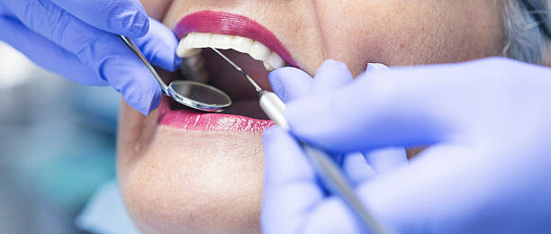 Best Knocked-Out Tooth (Avulsed Tooth) Treatment in Combes, TX